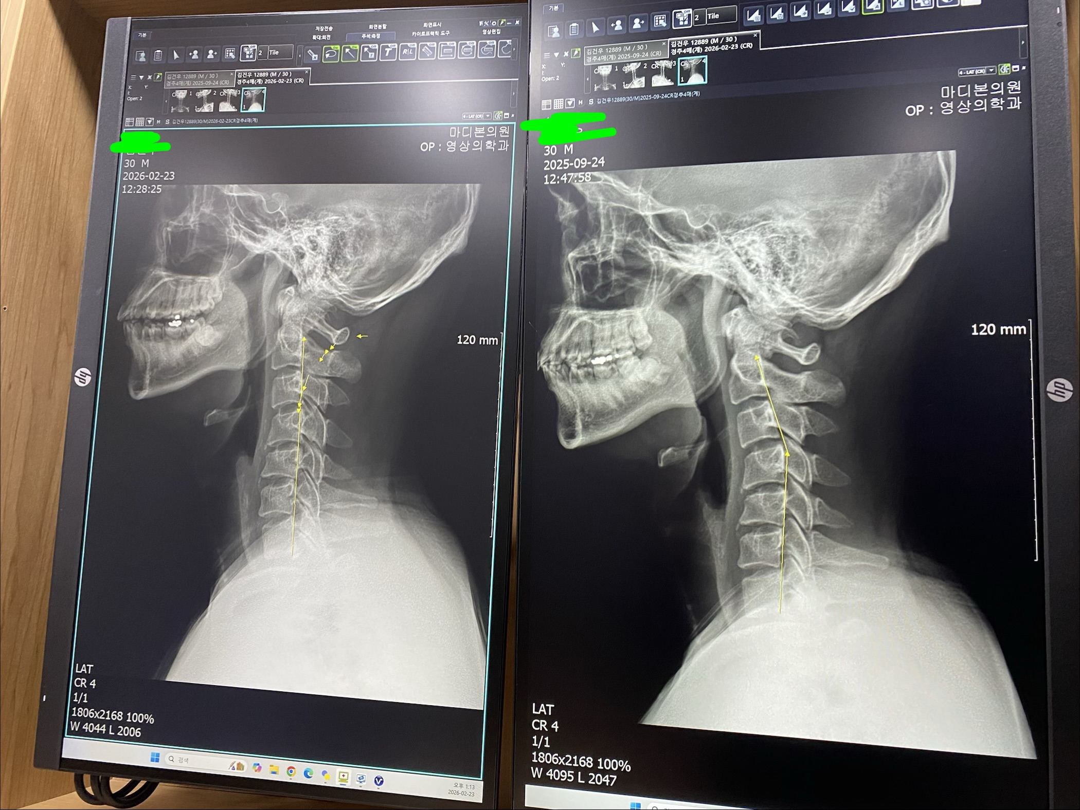 kakaotalk 20260311 103535603