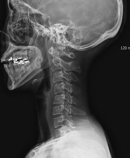 목 배열 경추배게