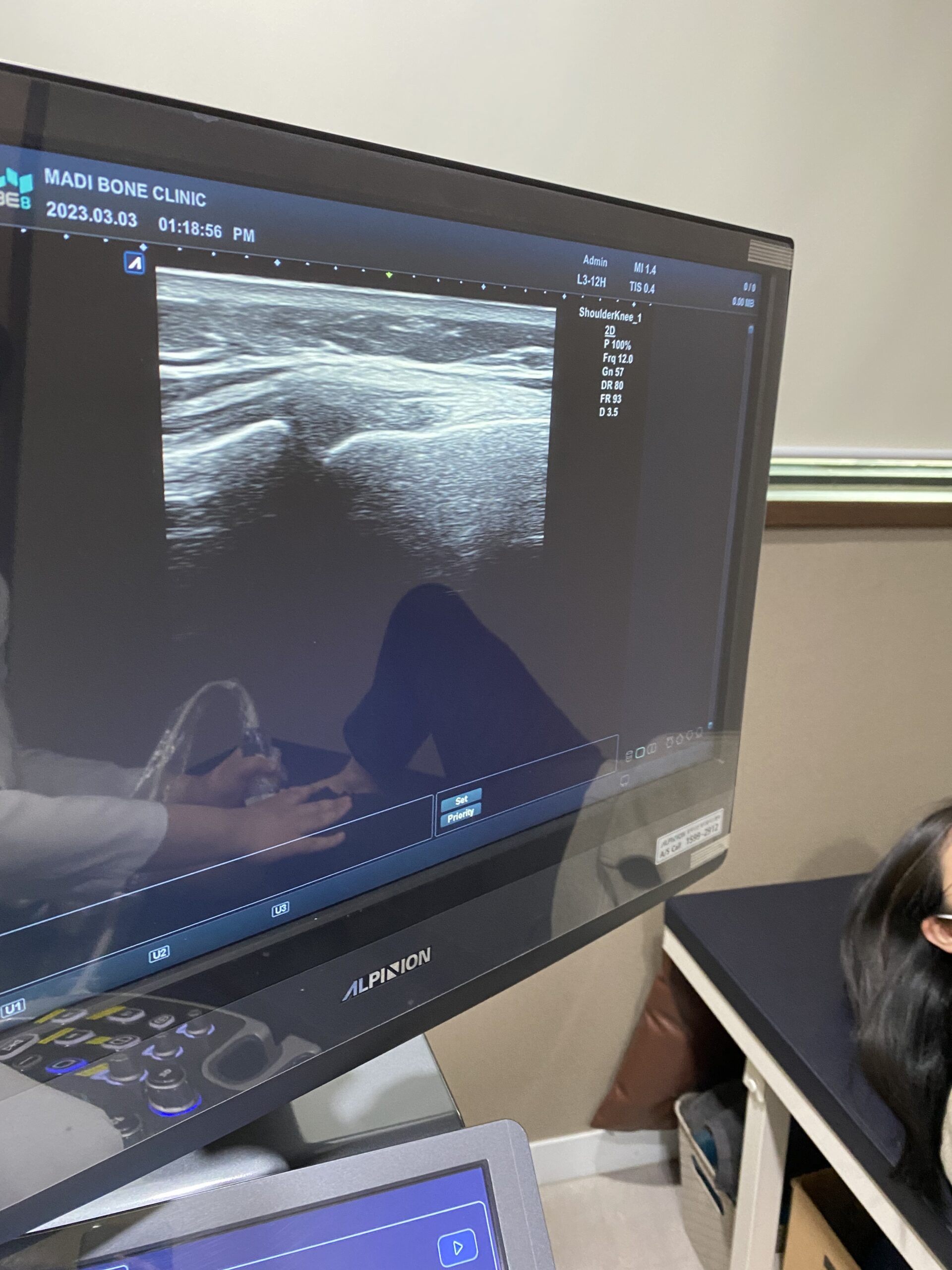 Overcoming Knee Pain with Exercise? The Hidden Trap of Overuse Knee Pain